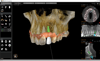 22855_Digital_Dentist_Ed_1_Blog_Thumb_1-328x200.png
