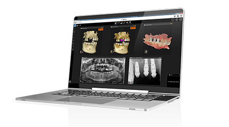 carestream dental imaging software free download