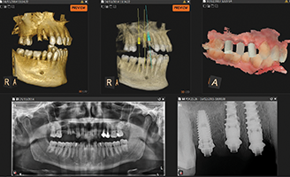 22855_Digital_Dentist_Ed_3_Blog_Thumb_3-Benito_328x200.png